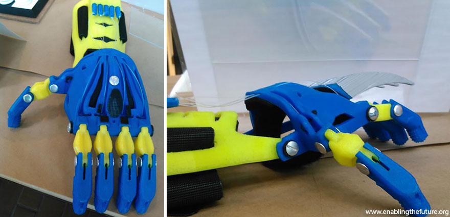 3d-printed-super-hero-prosthetic-limbs-enabling-the-future-17