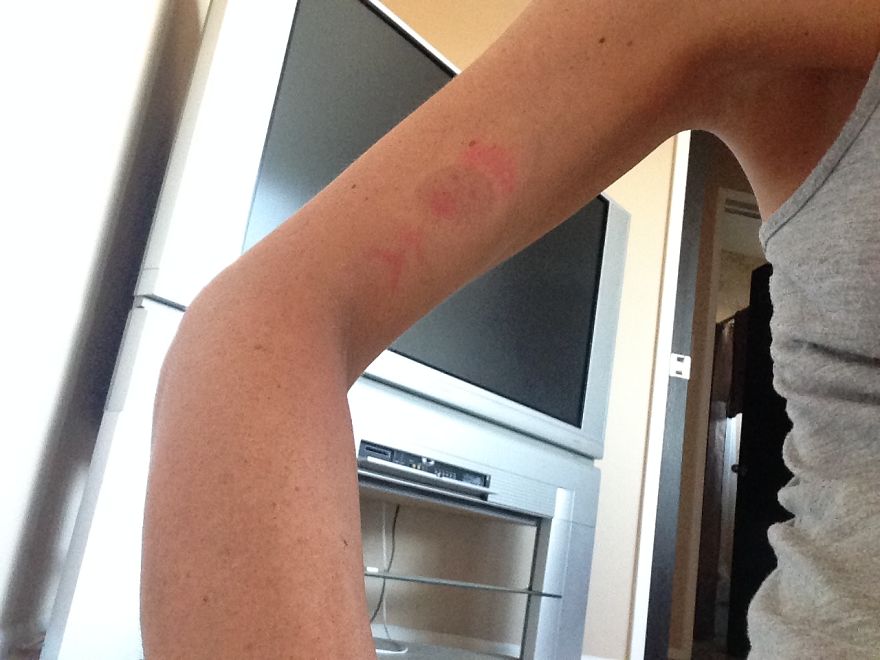 I Accidentally Burned A Naked Model With My Magic Wand (10 Photos)
