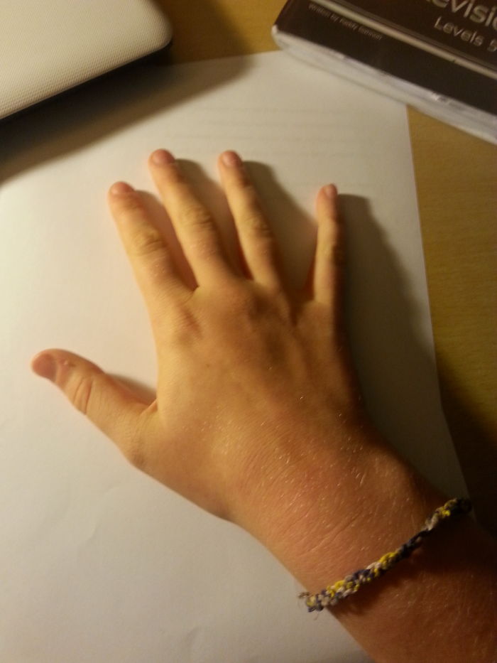 My Hand :)
