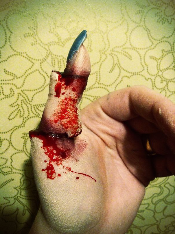 Chopped Thumb