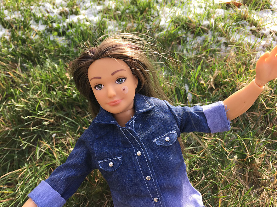"Normal Barbie" Has Realistic 19-Year-Old Body Shape With Acne, Bruises And Stretch Marks