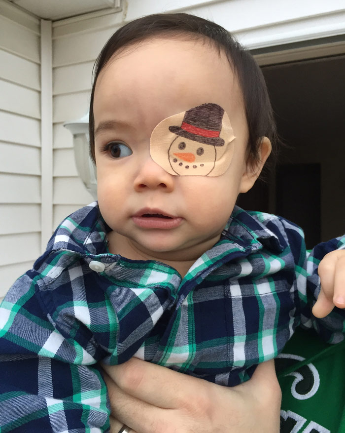 This Girl Has To Wear An Eyepatch, So Her Dad Tries To Make The Best Of It