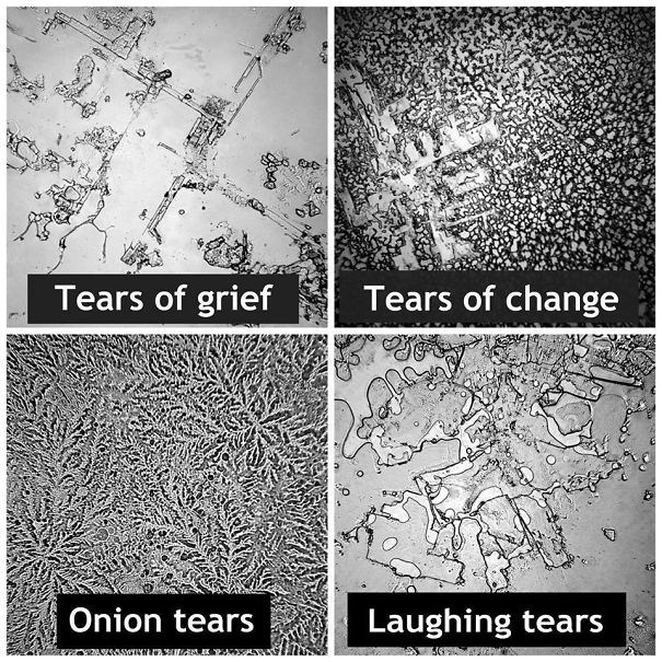 It Matters Why You Cry - Different Types Of Tears.