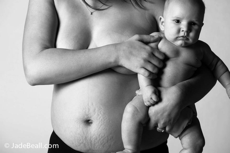 Post-Pregnancy Photo Series Shows How Mothers' Bodies Look After Giving Birth