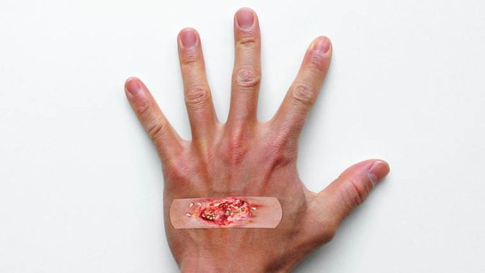 Are These Band-aids To Realistic?