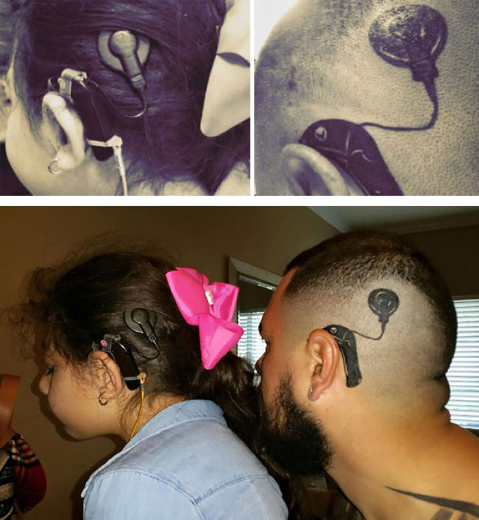 Este padre se hizo un tatuaje para que su hija no se sintiera extraña con su implante