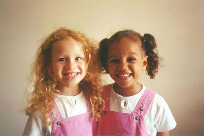 black-white-skin-twin-sisters-lucy-maria-aylmer-8