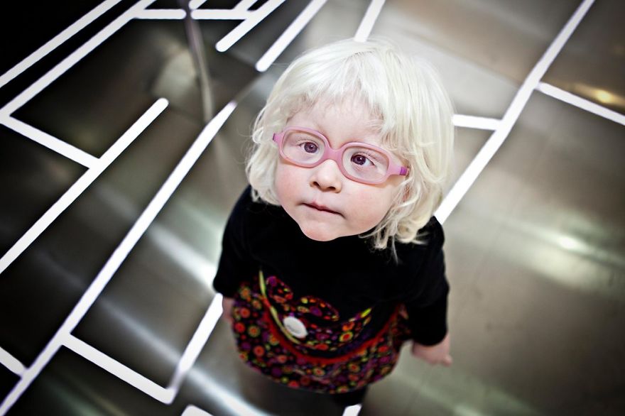 A Girl With Albinism, Valencia, Spain