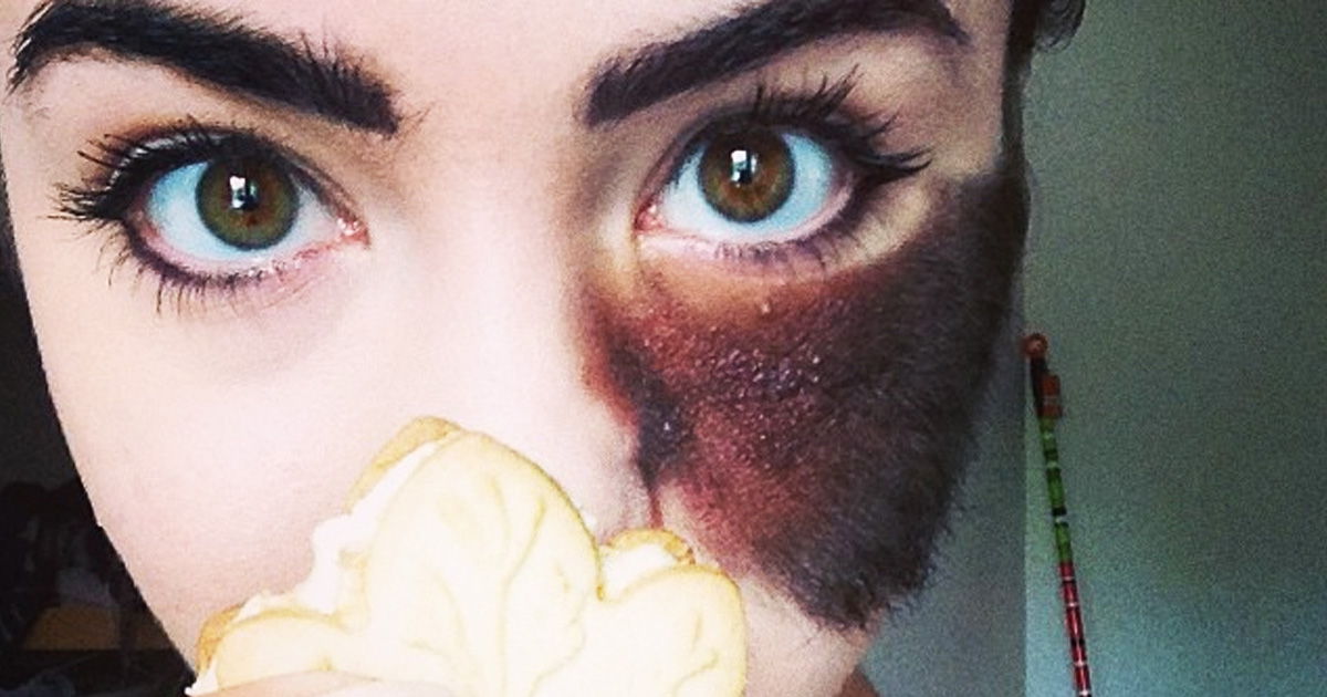 People Told Her To Remove Her Birthmark, But She Chose To Embrace It  Instead