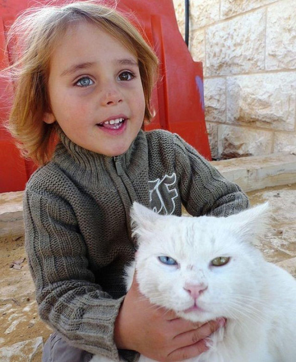 This Israeli Boy And His Cat Both Have Heterochromic Eyes!