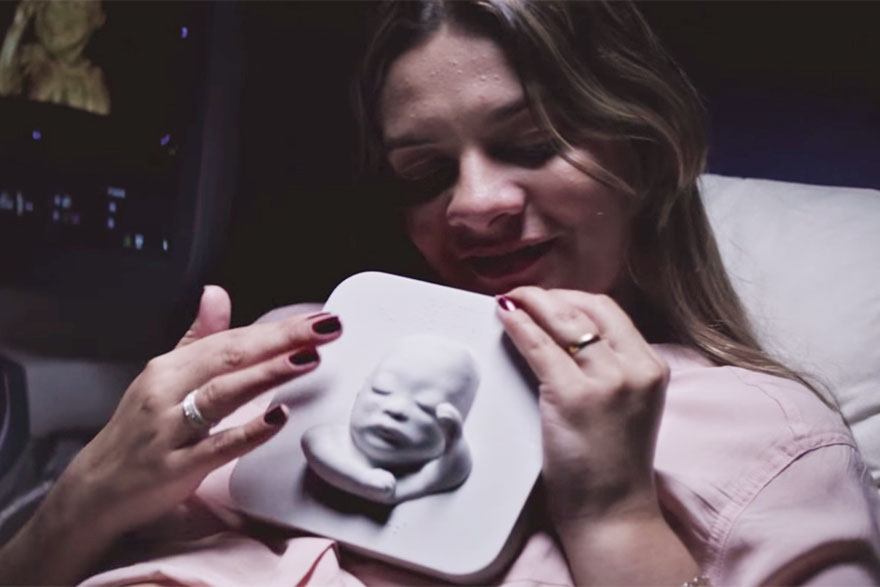 blind-pregnant-woman-first-look-unborn-son-3d-printing-ultrasound-huggies-8