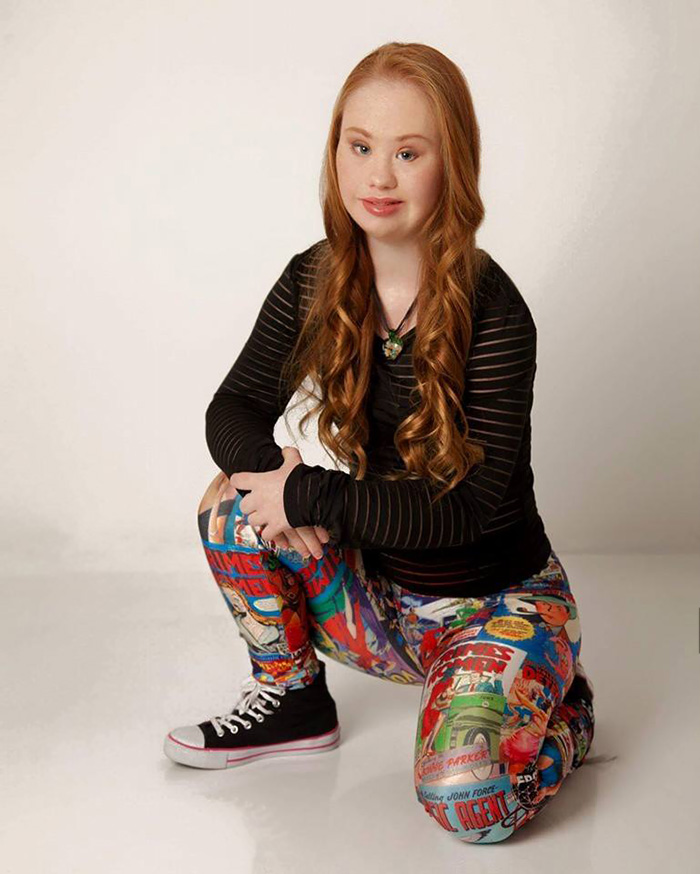 Teen With Down Syndrome Is Determined To Become A Model