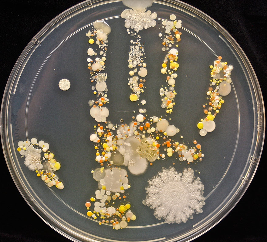 Microbes On 8-Year-Old Boy's Handprint After Playing Outside