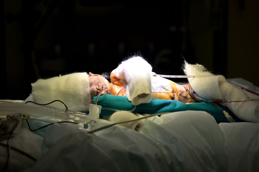 Gentle Violence: A Visual Exploration Of The Body During Open Heart Surgeries