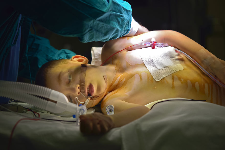 Gentle Violence: A Visual Exploration Of The Body During Open Heart Surgeries
