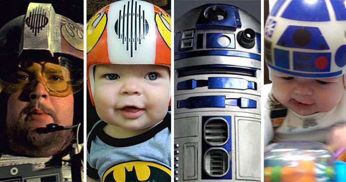 Dad Turns Son’s Head-Shaping Helmets Into Star Wars Art To Wear After Surgery