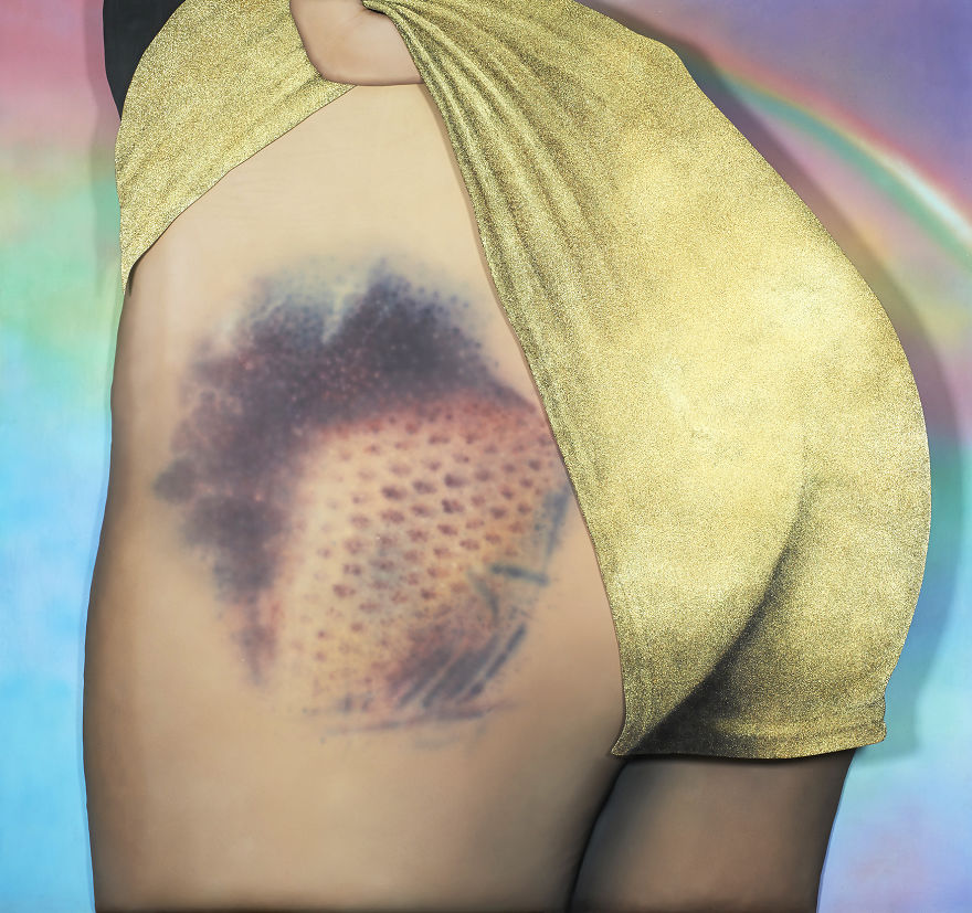 The Beauty Of Bruises: I Captured These Mini-Galaxies On The Butts Of Roller-Derby Girls