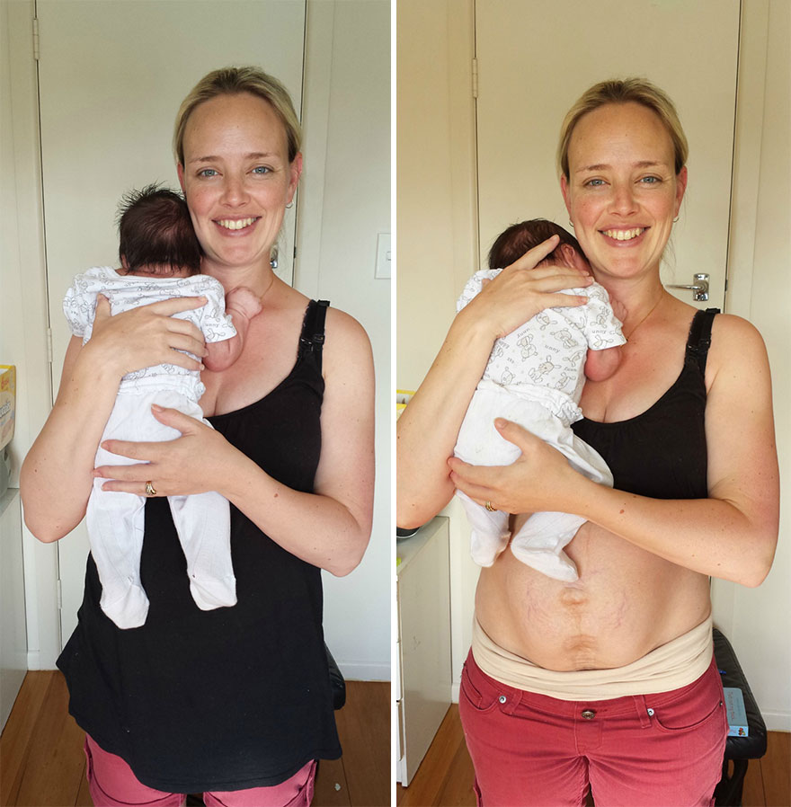 My Real Postpartum Body: I Want Every Mom To Know That It's Normal And You're Beautiful