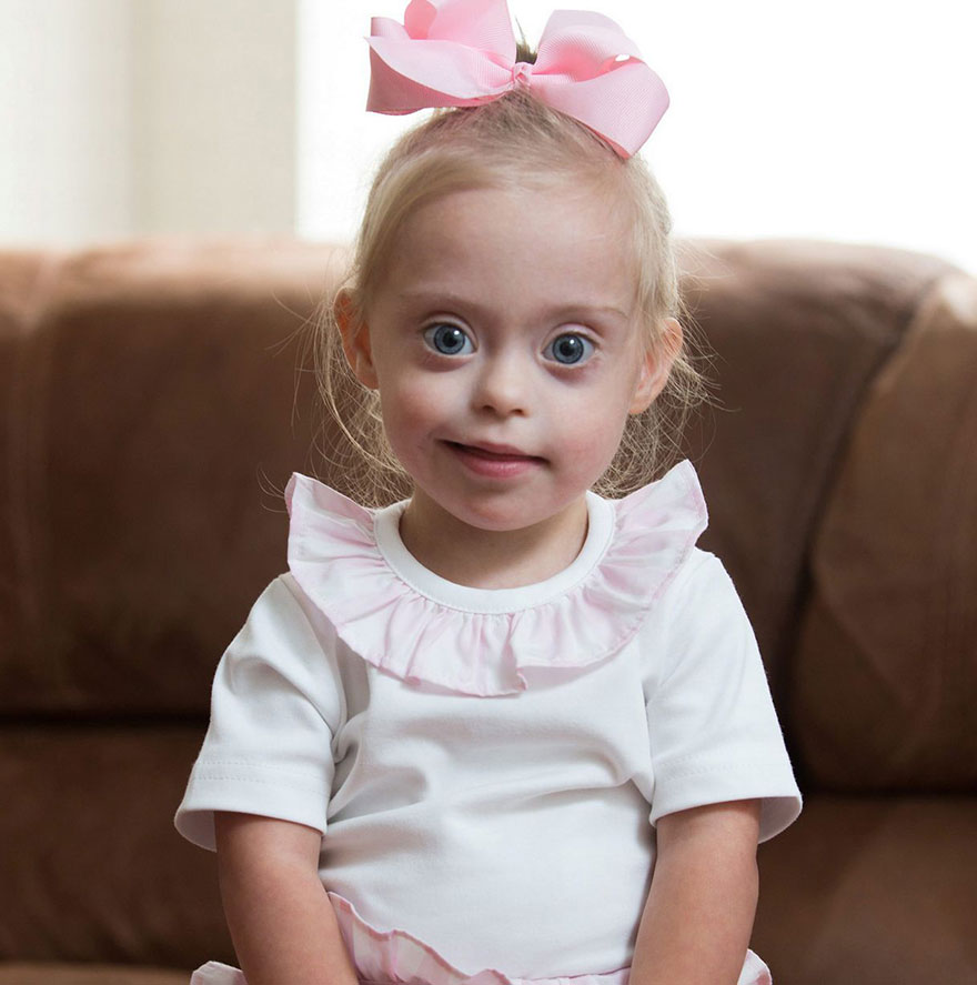2-Year-Old Girl With Down Syndrome Wins Modeling Contract Thanks To Her Cheeky Smile