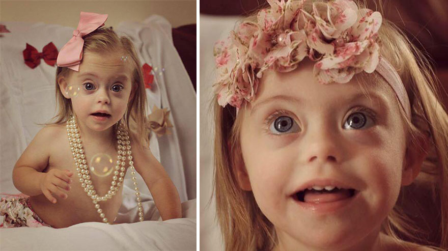 2-Year-Old Girl With Down Syndrome Wins Modeling Contract Thanks To Her Cheeky Smile