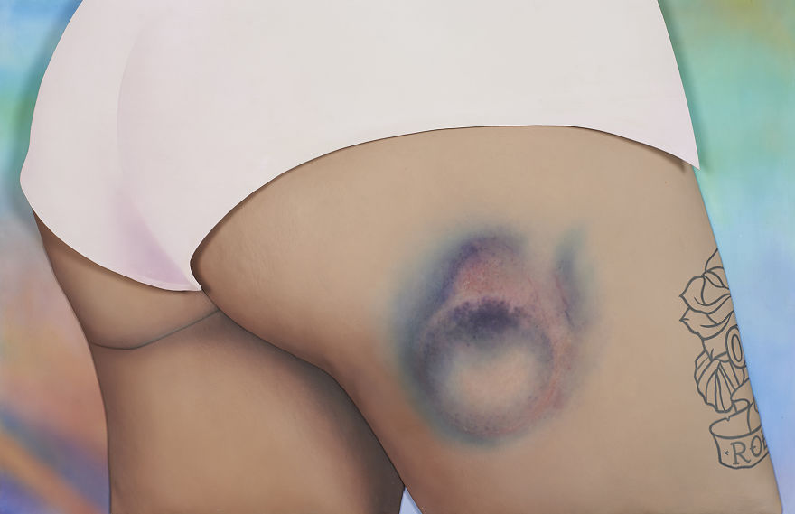 The Beauty Of Bruises: I Captured These Mini-Galaxies On The Butts Of Roller-Derby Girls