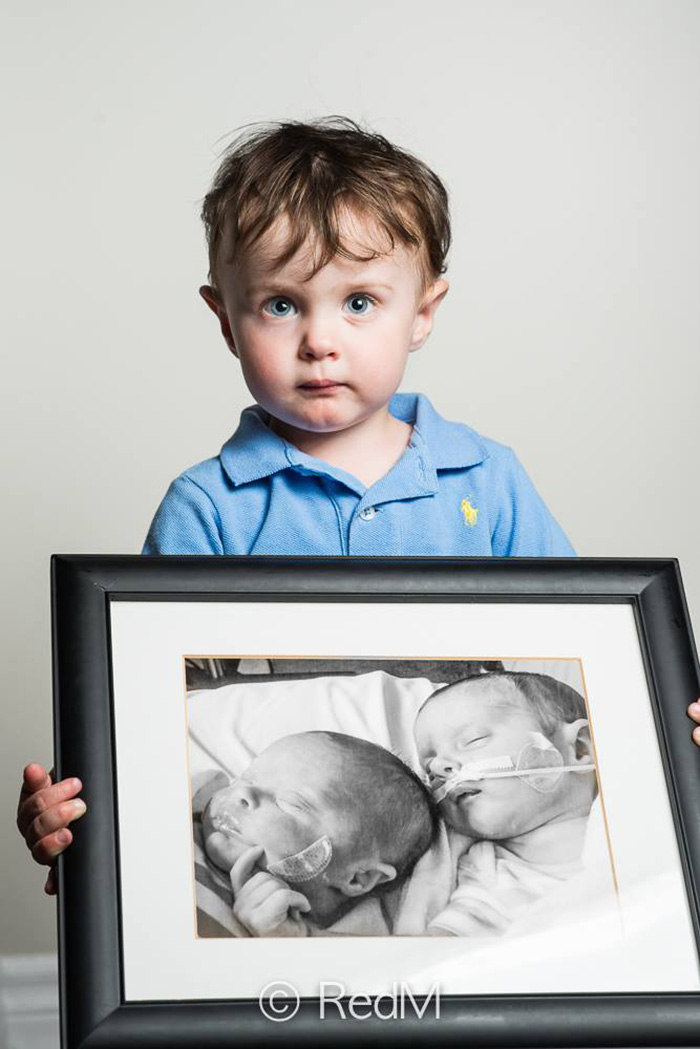 premature-baby-portraits-les-premas-red-methot-17