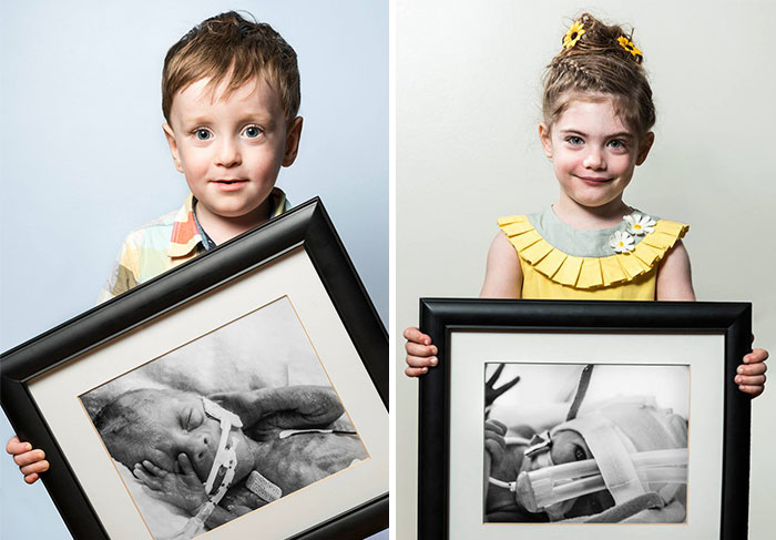 Powerful Before-And-After Portraits Of Premature Babies