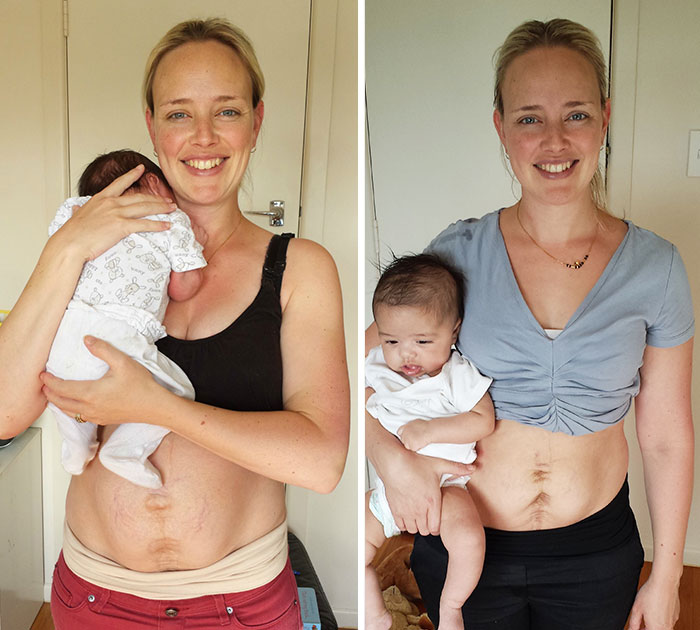 My Real Postpartum Body: I Want Every Mom To Know That It’s Normal And You’re Beautiful