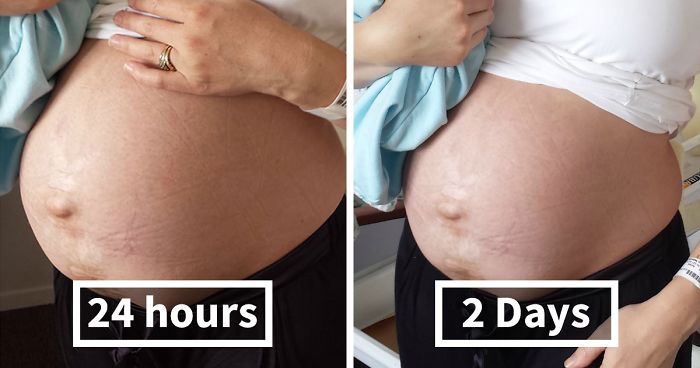 My Real Postpartum Body: I Want Every Mom To Know That It's Normal And  You're Beautiful