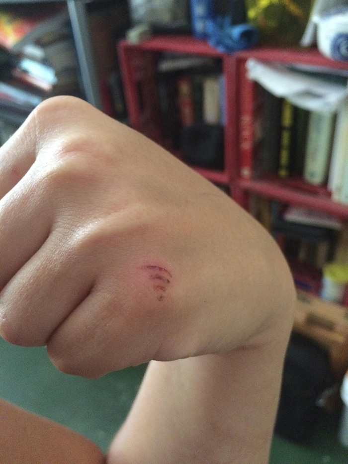 So I Cut My Hand With A Fan And Now It Looks Like I'm Emitting Wifi