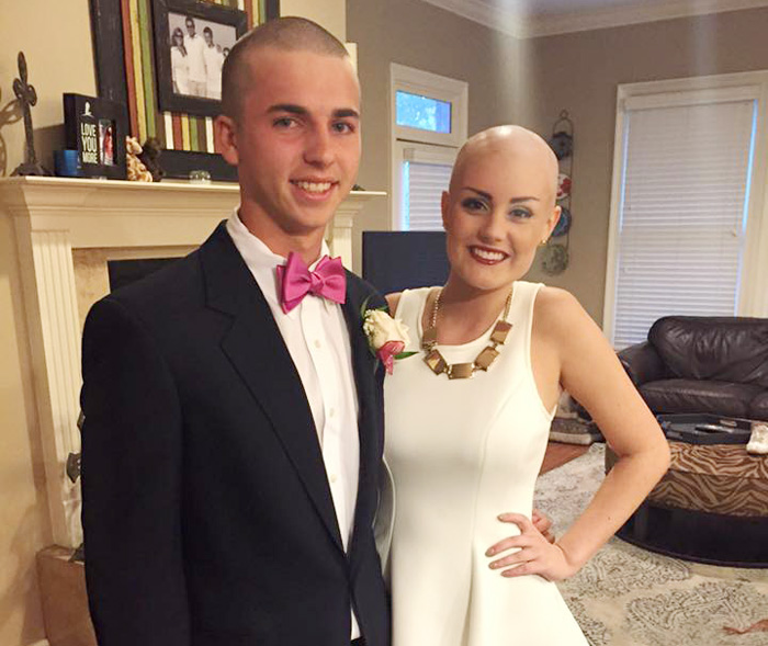 Teen Shaved Head To Surprise His Date Battling Cancer When She Came Back From Hospital
