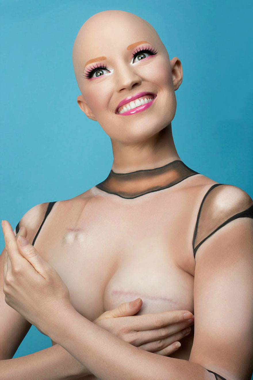 Woman Captures Every Stage Of Her Mastectomy In Creative Photo Series