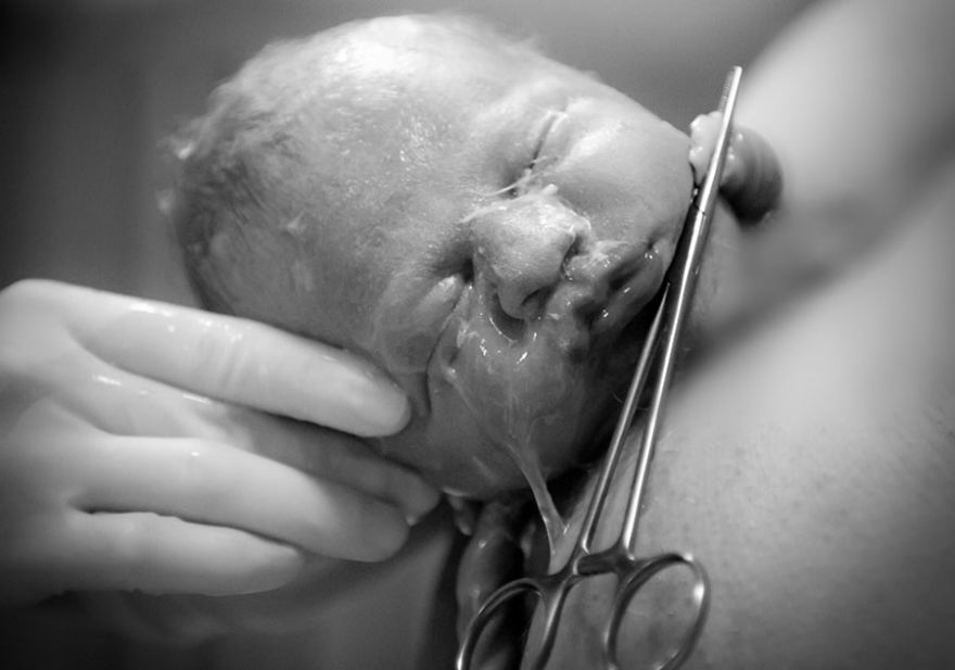 Artist Makes Amazing Photos: The Moment The Baby's Head Is Pushed During Birth