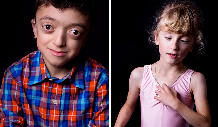 I Photograph Children With Rare Diseases To Encourage People To Look Beyond Their Condition