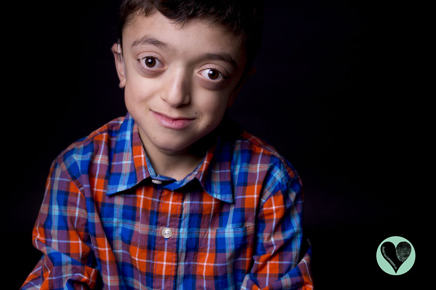 I Photograph Children With Rare Diseases To Encourage People To Look Beyond Their Condition