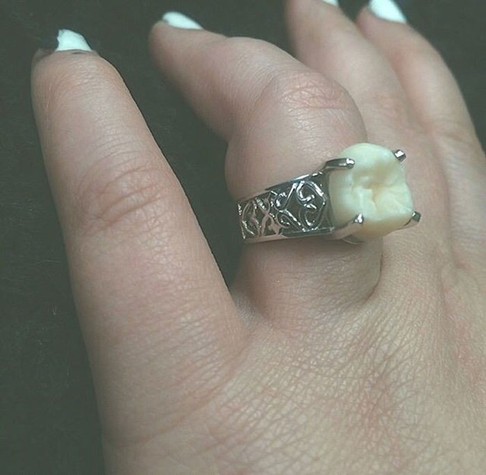 wisdom-tooth-engagement-ring-carlee-leifkes-lucas-unger-24
