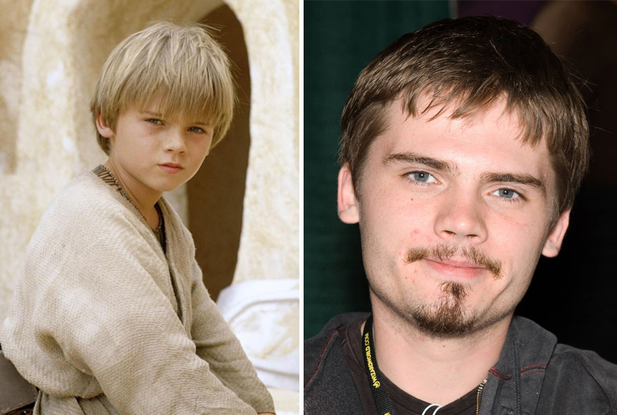 Jake Lloyd As Young Anakin Skywalker, 1999 And 2015