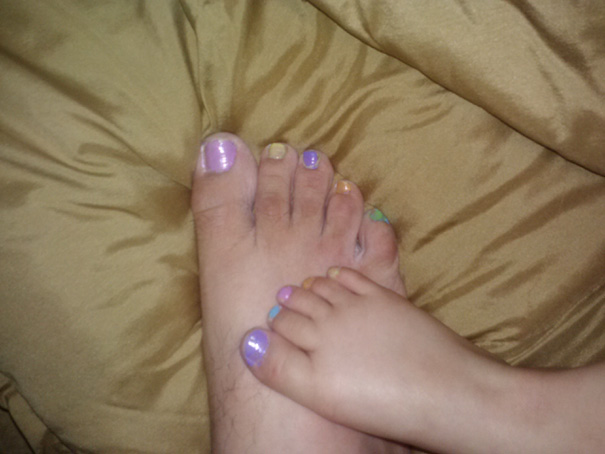 My 4 Y/O Daughter Decided To Paint My Nails To Match. Wouldn't Be So Odd But I'm A 28 Y/O Single Dad