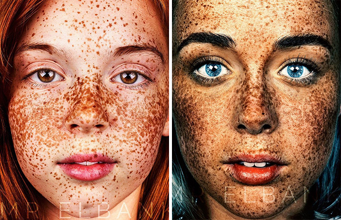 Unique Beauty Of Freckled People Documented By Brock Elbank