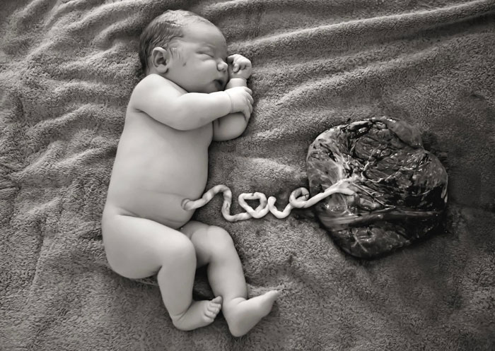 Mom Celebrates Birth With A Pic Of Her Newborn’s Umbilical Cord Spelling Out ‘LOVE’