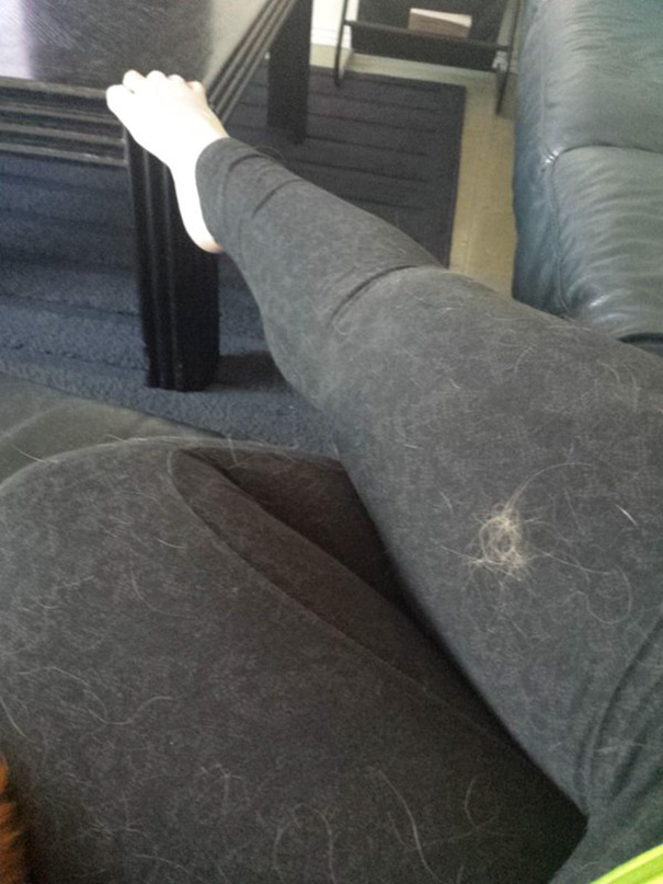 My Legs Are Absolutely Covered In Dog Hair