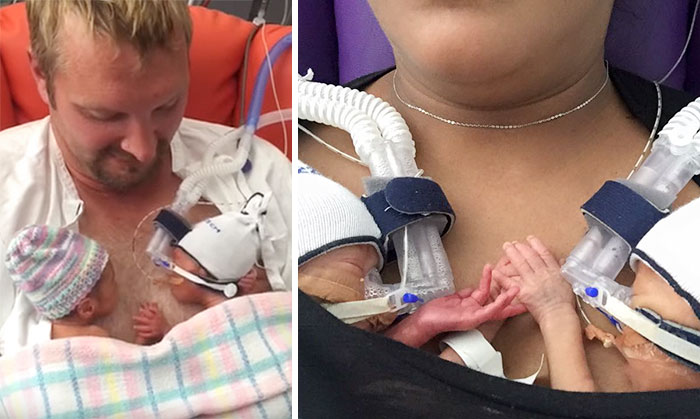 Premature Twins Holding Hands Take Internet By Storm