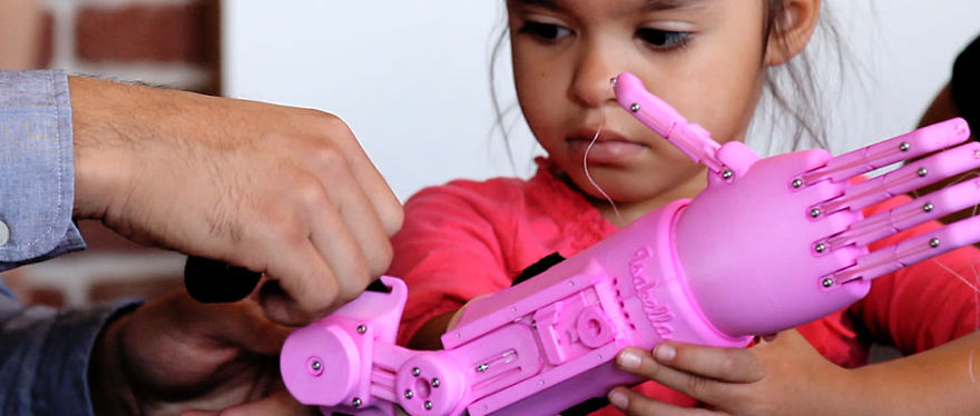 5-Year-Old Born With An Underdeveloped Hand Gets A 3D Printed One