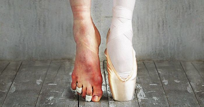 The Cost Of Applause: 77 Pics To Celebrate Ballet Day | Bored Panda