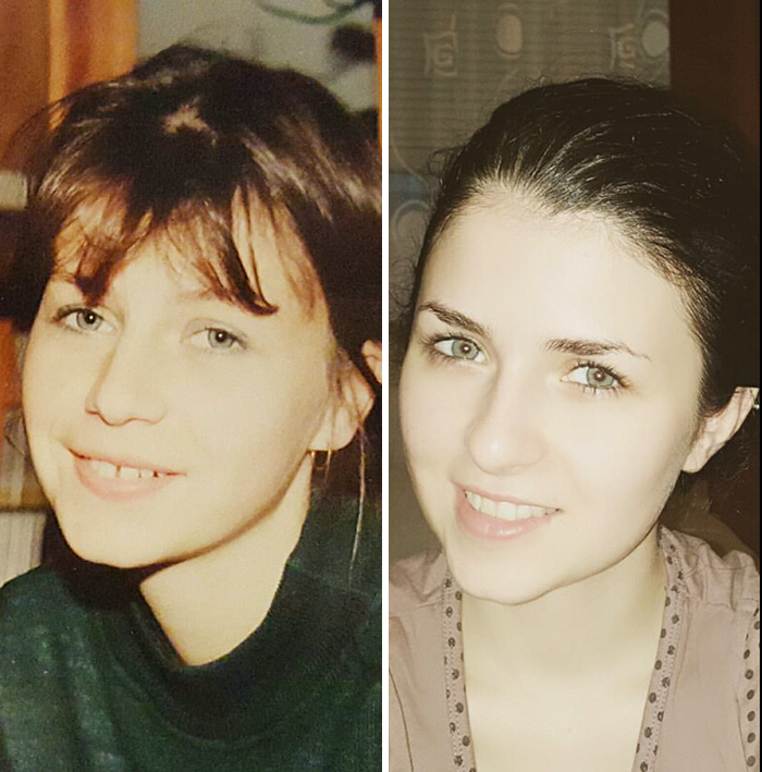 My Mom And I At Same Age Of 24. I Look So Much Like Her