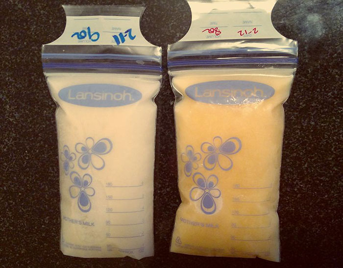 Mom Posts Her Breast Milk’s Side-By-Side Pic And It Goes Viral For The Most Beautiful Reason