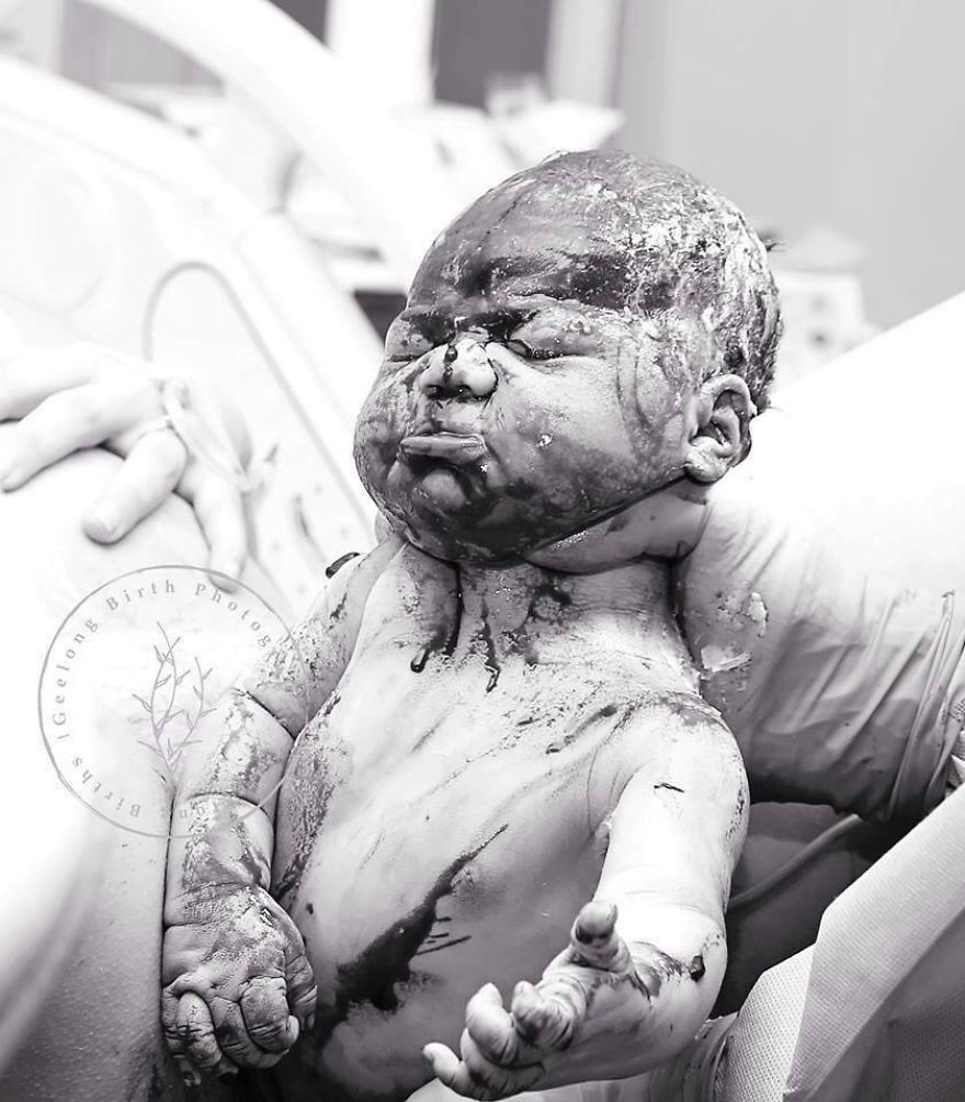 The Best Birth Images You Will Never See Because It Violates Community Standards..