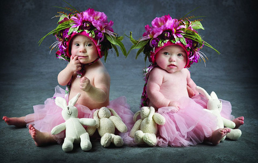 babies-downs-syndrome-awareness-charity-calendar-13