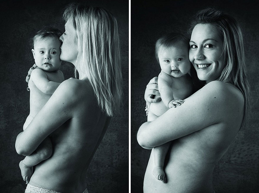 Babies with Down's Syndrome Pose For Adorable Charity Photoshoot