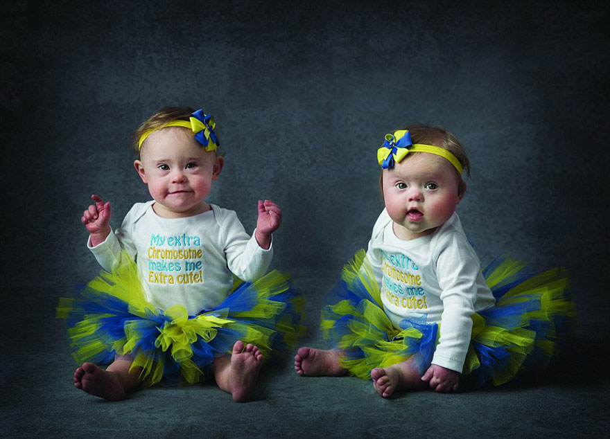 Babies with Down's Syndrome Pose For Adorable Charity Photoshoot